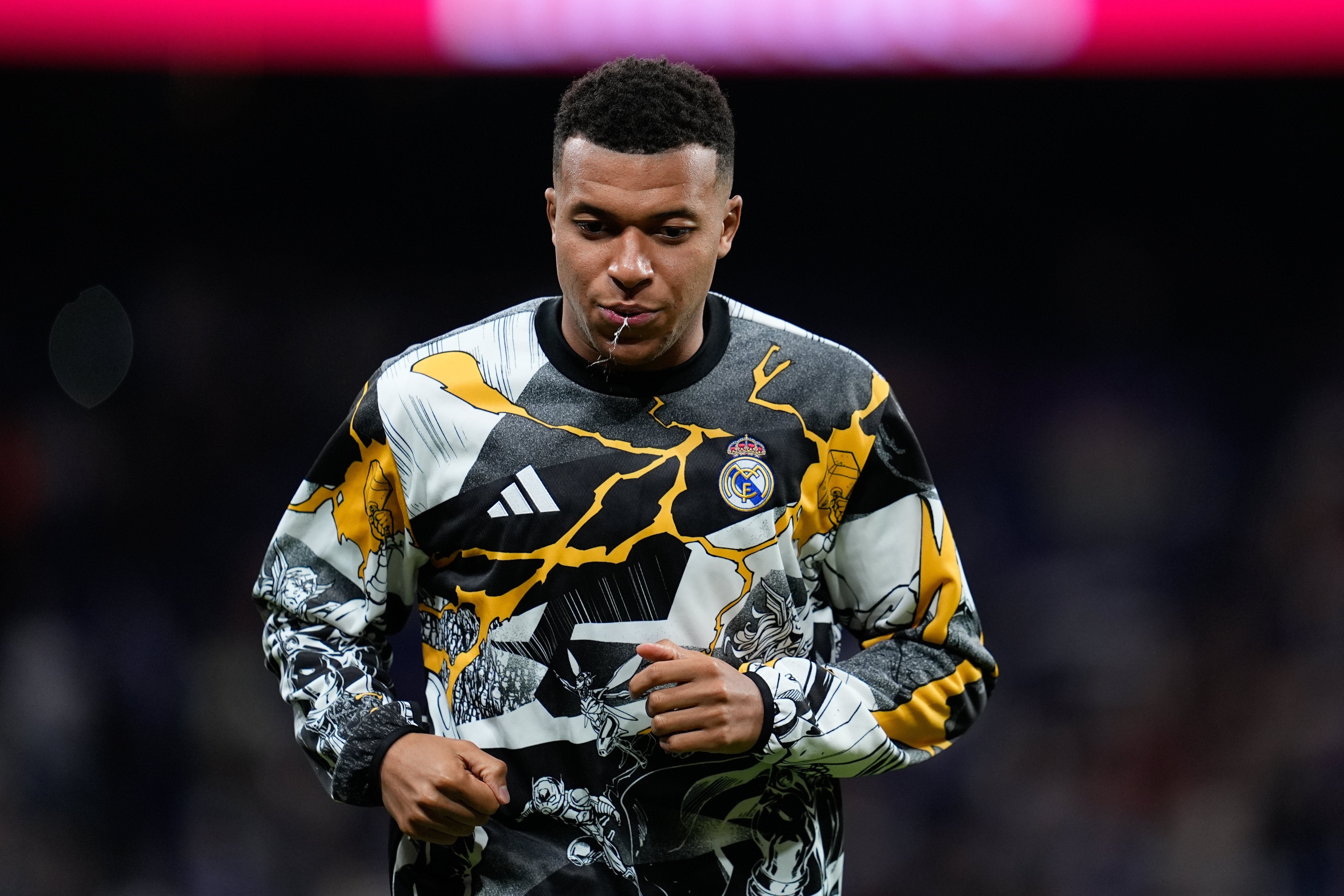 Мбаппе сломал палец перед матчем Лиги чемпионов с «Манчестер Сити».